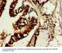 TROVE2 Antibody