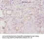 TROVE2 Antibody