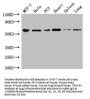 TROVE2 Antibody
