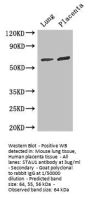 STAU1 Antibody
