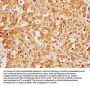 CFHR1 Antibody