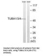 TUBA1A/TUBA1B/TUBA1C/TUBA3C/TUBA3E/TUBA4A (Ab-272) Antibody