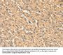 PHKB Antibody