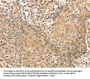PHKB Antibody