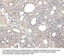 VPS37D Antibody