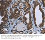 GCK Antibody