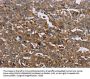 GCK Antibody