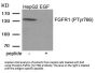 Phospho-FGFR1 (Tyr766) Antibody