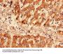 Rabbit anti-human Serum amyloid A-1 protein polyclonal Antibody