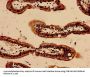 Rabbit anti-human Serum amyloid A-1 protein polyclonal Antibody