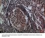 IL17D Antibody