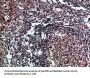 IL17D Antibody