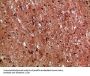 IL17D Antibody