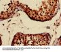 CRAT Antibody