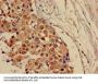 CRAT Antibody