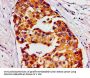 HMMR Antibody