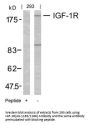 IGF1R (Ab-1165/1166) Antibody