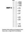 MMP9 Antibody