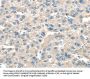 TNFAIP8 Antibody