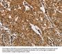 PTK6 Antibody