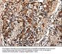 Rabbit anti-human TTR polyclonal antibody