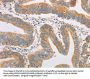 FARSB Antibody