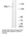 IRS1 (Ab-312) Antibody