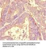 A2M Antibody