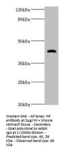HP Antibody