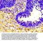 HP Antibody