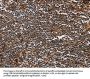 MAGEA3 Antibody