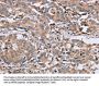 MAGEA3 Antibody