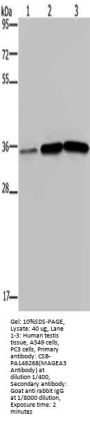 MAGEA3 Antibody