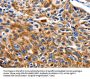 NEFL Antibody