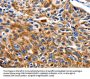 NEFL Antibody