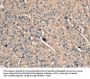 SCN1B Antibody