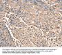 SCN1B Antibody