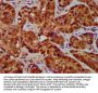 TFR2 Antibody