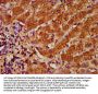 TFR2 Antibody