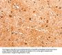 Rabbit anti-human FABP7 polyclonal antibody