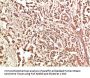 PTK2 Antibody
