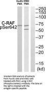 Phospho-RAF1 (Ser642) Antibody