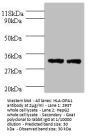 HLA-DPA1 Antibody