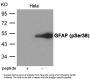 Phospho-GFAP (Ser38) Antibody