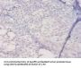 HLA-DQA1 Antibody