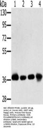 PDLIM1 Antibody