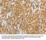 PRPSAP1 Antibody