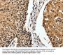 ITGAM Antibody
