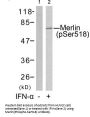 Phospho-NF2 (Ser518) Antibody