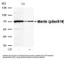 Phospho-NF2 (Ser518) Antibody